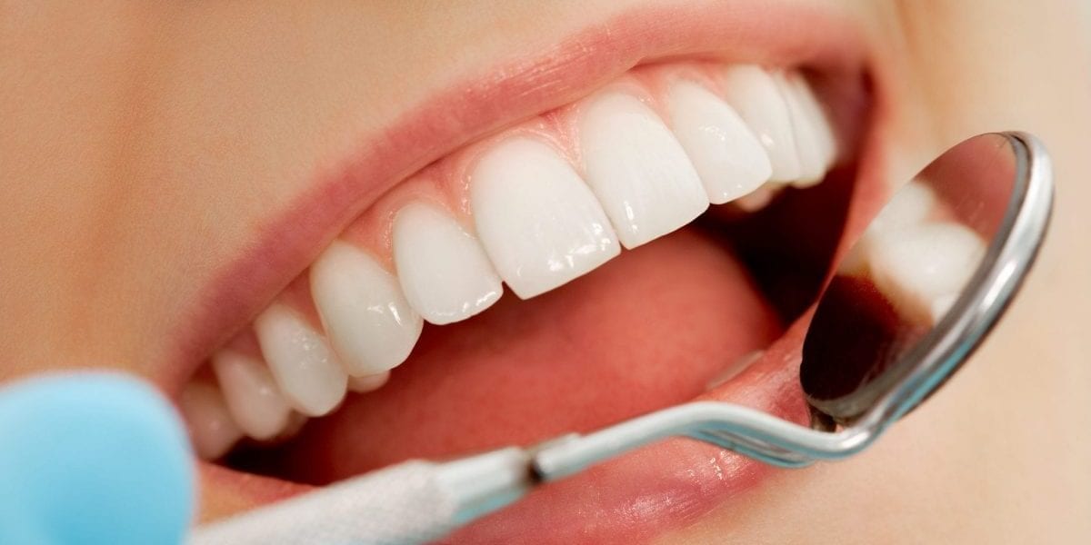 Dental Crown Houston: Enhancing Your Smile